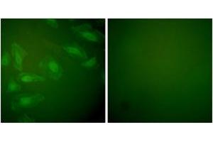 Immunofluorescence analysis of HeLa cells, using DJ-1 Antibody. (PARK7/DJ1 antibody  (AA 21-70))