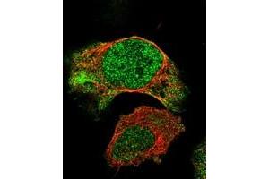Immunofluorescent staining of human cell line U-2 OS with BNC2 polyclonal antibody  at 1-4 ug/mL dilution shows positivity in nucleus and cytoplasm. (Basonuclin 2 antibody)