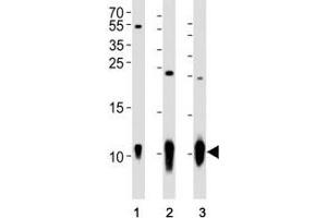 Western blot analysis of lysate from (1) A431 cell line, (2) mouse brain and (3) rat brain tissue using S100B antibody at 1:1000.