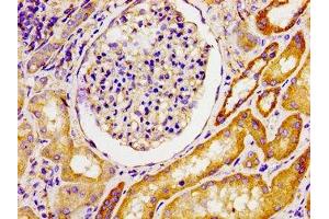 Immunohistochemistry of paraffin-embedded human kidney tissue using ABIN7142689 at dilution of 1:100 (MPP1 antibody  (AA 123-252))