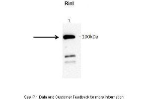 Amount and Sample Type : GFP-hRinl transfected COS7 cell lysate Amount of IP Antibody : 10ug Primary Antibody : anti-GFP Primary Antibody Dilution : 1:1000 Secondary Antibody : Goat anti-rabbit-HRP Secondary Antibody Dilution : 1:5000 Gene Name : RINL Submitted by : Barbara Woller; Medical University of Vienna (RINL antibody  (N-Term))
