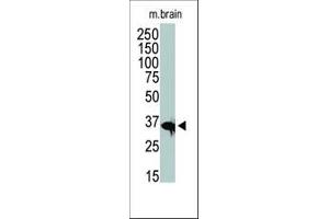 The anti-HDAC11 Pab (ABIN387965 and ABIN2844703) is used in Western blot to detect HDAC11 in mouse brain tissue lysate. (HDAC11 antibody  (C-Term))