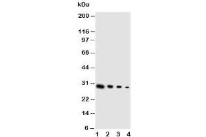 Western blot testing of GDNF antibody and Lane 1:  recombinant human protein 10ng