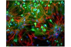 Image no. 2 for anti-Ubiquitin Carboxyl-terminal Esterase L1 (Ubiquitin Thiolesterase) (UCHL1) antibody (ABIN372739) (UCHL1 antibody)