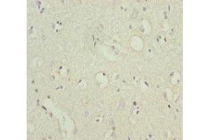 Immunohistochemistry of paraffin-embedded human brain tissue using ABIN7164067 at dilution of 1:100 (POU4F3 antibody  (AA 1-180))