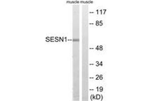Western blot analysis of extracts from rat muscle cells, using SESN1 Antibody. (SESN1 antibody  (AA 271-320))