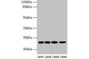 Western blot All lanes: CBX5 antibody at 9 μg/mL Lane 1: K562 whole cell lysate Lane 2: MCF-7 whole cell lysate Lane 3: 293T whole cell lysate Lane 4: Hela whole cell lysate Secondary Goat polyclonal to rabbit IgG at 1/10000 dilution Predicted band size: 23 kDa Observed band size: 23 kDa (CBX5 antibody  (AA 1-191))