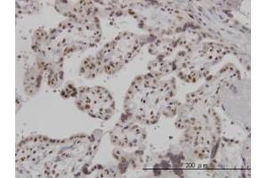 Image no. 1 for anti-ADP-Ribosylation-Like Factor 6 Interacting Protein 4 (ARL6IP4) (AA 261-361) antibody (ABIN466208) (ARL6IP4 antibody  (AA 261-361))