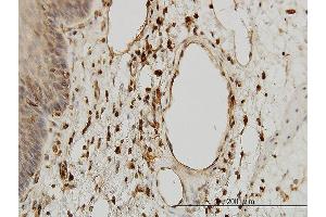 Immunoperoxidase of monoclonal antibody to B2M on formalin-fixed paraffin-embedded human esophagus. (beta-2 Microglobulin antibody  (AA 1-119))