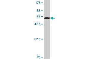 Western Blot detection against Immunogen (52. (HIV-1 Tat Interactive Protein 2, 30kDa (HTATIP2) (AA 1-242) antibody)