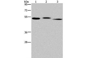 Western Blot analysis of Human kidney tissue, HepG2 cell and Human testis tissue using HYAL3 Polyclonal Antibody at dilution of 1:400