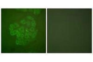Immunofluorescence analysis of A549 cells, using GR (Ab-211) antibody. (Glucocorticoid Receptor antibody  (Ser211))