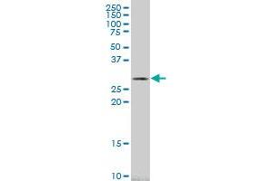 CA1 monoclonal antibody (M10), clone 1F1. (CA1 antibody  (AA 1-261))