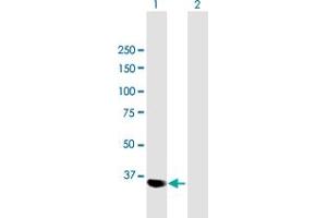 PARVG antibody  (AA 1-331)