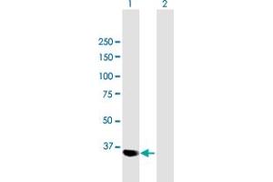 Western Blot analysis of PARVG expression in transfected 293T cell line by PARVG MaxPab polyclonal antibody. (PARVG antibody  (AA 1-331))