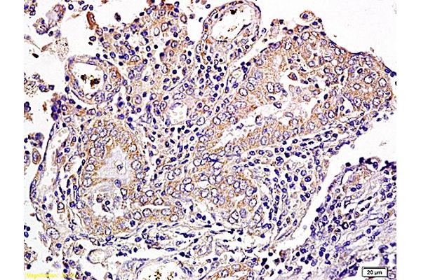 CD1a antibody  (AA 151-250)