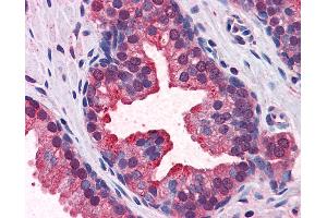 Anti-KEAP1 antibody IHC of human prostate. (KEAP1 antibody  (AA 21-70))