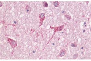 Anti-GPR83 antibody  ABIN1048881 IHC staining of human brain, neurons and neuropil. (GPR83 antibody  (Cytoplasmic Domain))