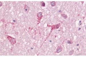 Anti-GPR83 antibody  ABIN1048881 IHC staining of human brain, neurons and neuropil.