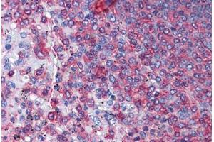 Human Spleen: Formalin-Fixed, Paraffin-Embedded (FFPE) (Actin, gamma 1 antibody  (AA 1-119))