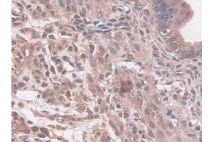 Detection of NAT1 in Mouse Uterus Tissue using Polyclonal Antibody to N-Acetyltransferase 1 (NAT1) (NAT1 antibody  (AA 9-254))