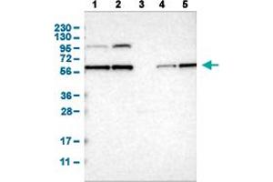 Western Blot analysis of (1) human cell line RT-4 (2) human cell line U-251MG sp (3) human plasma (IgG/HSA depleted) (4) human liver tissue, and (5) human tonsil tissue. (PPM1B antibody  (AA 359-463))