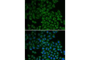 Immunofluorescence (IF) image for anti-serum/glucocorticoid Regulated Kinase 1 (SGK1) (AA 172-431) antibody (ABIN3021291)