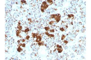 Formalin-fixed, paraffin-embedded human Pituitary stained with ACTH Monoclonal Antibody (SPM501). (POMC antibody  (AA 25-39))