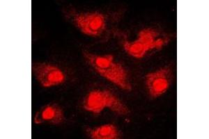 Immunofluorescent analysis of FOXO1 staining in MCF7 cells. (FOXO1 antibody  (Center))