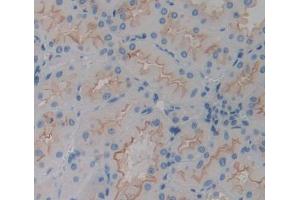 Used in DAB staining on fromalin fixed paraffin- embedded kidney tissue (CHRNA3 antibody  (AA 32-240))