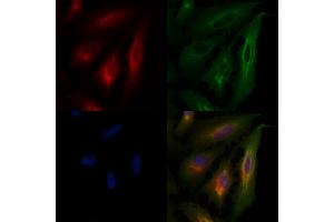 ABIN6265634 and ABIN6266663 staining  cells by IF/ICC.