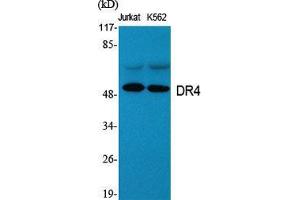 Western Blot (WB) analysis of specific cells using DR4 Polyclonal Antibody. (DR4 antibody  (C-Term))