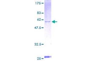 YWHAE Protein (AA 1-255) (GST tag)