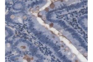 Detection of LPS in Rat Small intestine Tissue using Monoclonal Antibody to Lipopolysaccharide (LPS) (Lipopolysaccharides (LPS) antibody)