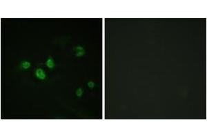 Immunofluorescence analysis of HeLa cells, using SP1 (Phospho-Thr453) Antibody. (SP1 antibody  (pThr453))