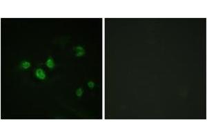 Immunofluorescence analysis of HeLa cells, using SP1 (Phospho-Thr453) Antibody. (SP1 antibody  (pThr453))