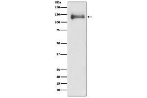 All Lanes: HDAC4 Antibody at 1/ 500 dilution. (Recombinant HDAC4 antibody)