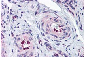 Human Uterus, Vessels (formalin-fixed, paraffin-embedded) stained with IL33 antibody ABIN343919 at 5 ug/ml followed by biotinylated goat anti-rabbit IgG secondary antibody ABIN481713, alkaline phosphatase-streptavidin and chromogen. (IL-33 antibody  (Internal Region))