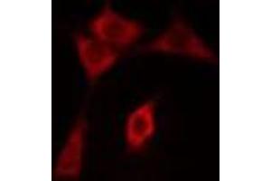 ABIN6275498 staining COLO205 cells by IF/ICC. (ARHGEF3 antibody  (C-Term))