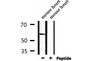 Western blot analysis of extracts from mouse heart, using PCTK2 Antibody. (CDK17 antibody  (Internal Region))