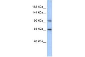 Image no. 1 for anti-Spindle and Centriole Associated Protein 1 (SPICE1) (AA 575-624) antibody (ABIN6743664) (SPICE1 antibody  (AA 575-624))