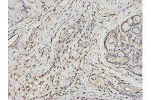 Immunohistochemistry (IHC) image for anti-Proteasome (Prosome, Macropain) Activator Subunit 1 (PA28 Alpha) (PSME1) antibody (ABIN1876546) (PSME1 antibody)