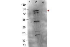Western blot showing detection of 0. (Flagellin antibody)