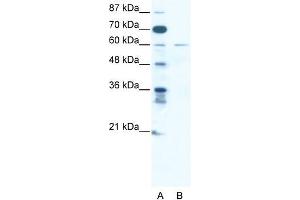Human Jurkat; WB Suggested Anti-ZNF92 Antibody Titration: 2.