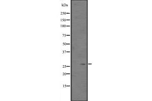 Western blot analysis of CITED2 expression in Hela cell lysate,The lane on the left is treated with the antigen-specific peptide. (CITED2 antibody  (Internal Region))