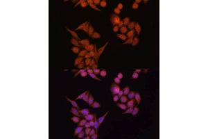Immunofluorescence analysis of HeLa cells using OCLN antibody. (Occludin antibody  (AA 263-522))