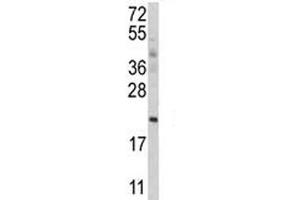 Western Blotting (WB) image for anti-Autophagy Related 12 (ATG12) (AA 1-50) antibody (ABIN3030084)