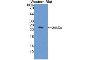 Western Blotting (WB) image for anti-Nucleoporin 35kDa (NUP35) (AA 132-310) antibody (ABIN1860083) (NUP35 antibody  (AA 132-310))