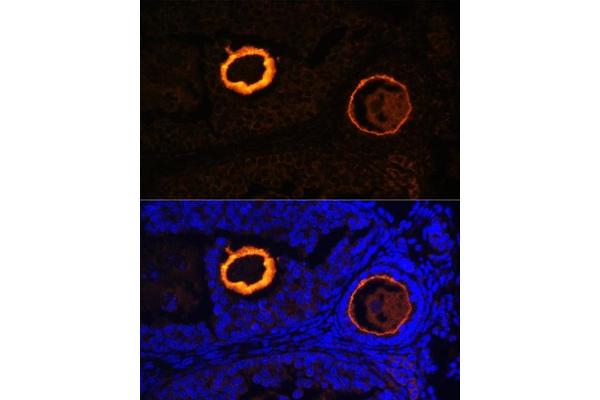 Zona Pellucida Glycoprotein 3 antibody  (AA 250-350)