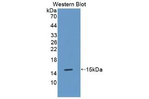 Detection of Recombinant MT3, Mouse using Polyclonal Antibody to Metallothionein 3 (MT3) (MT3 antibody  (AA 1-68))